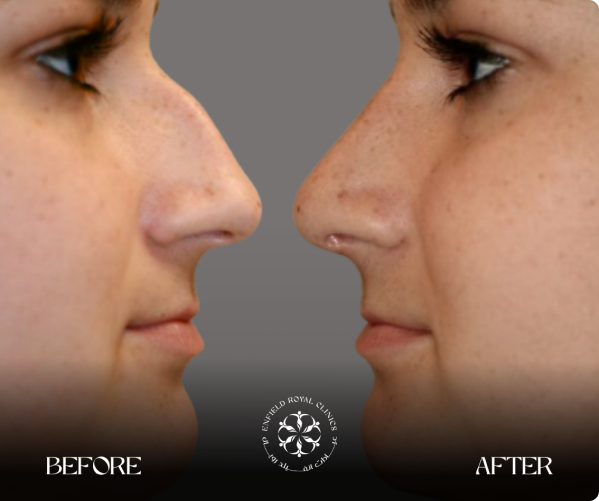 Real Patients, Remarkable Results