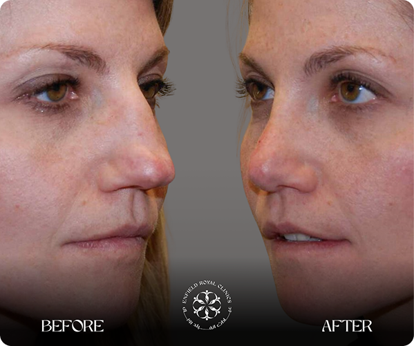 Real Patients, Remarkable Results