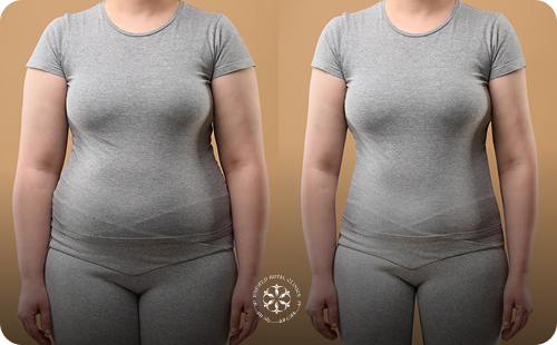 Group 2085662787 (1)