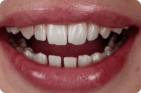 0-07-5.webp 0-07-5.webp