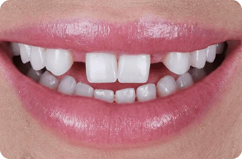 0-07-7.webp 0-07-7.webp