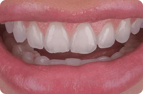 0-07-9.webp 0-07-9.webp